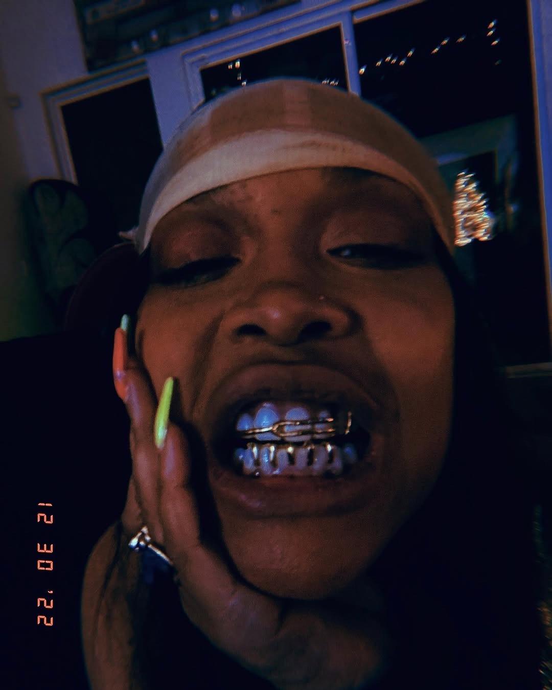 Erykah Badu’s grillz collection goes crazy