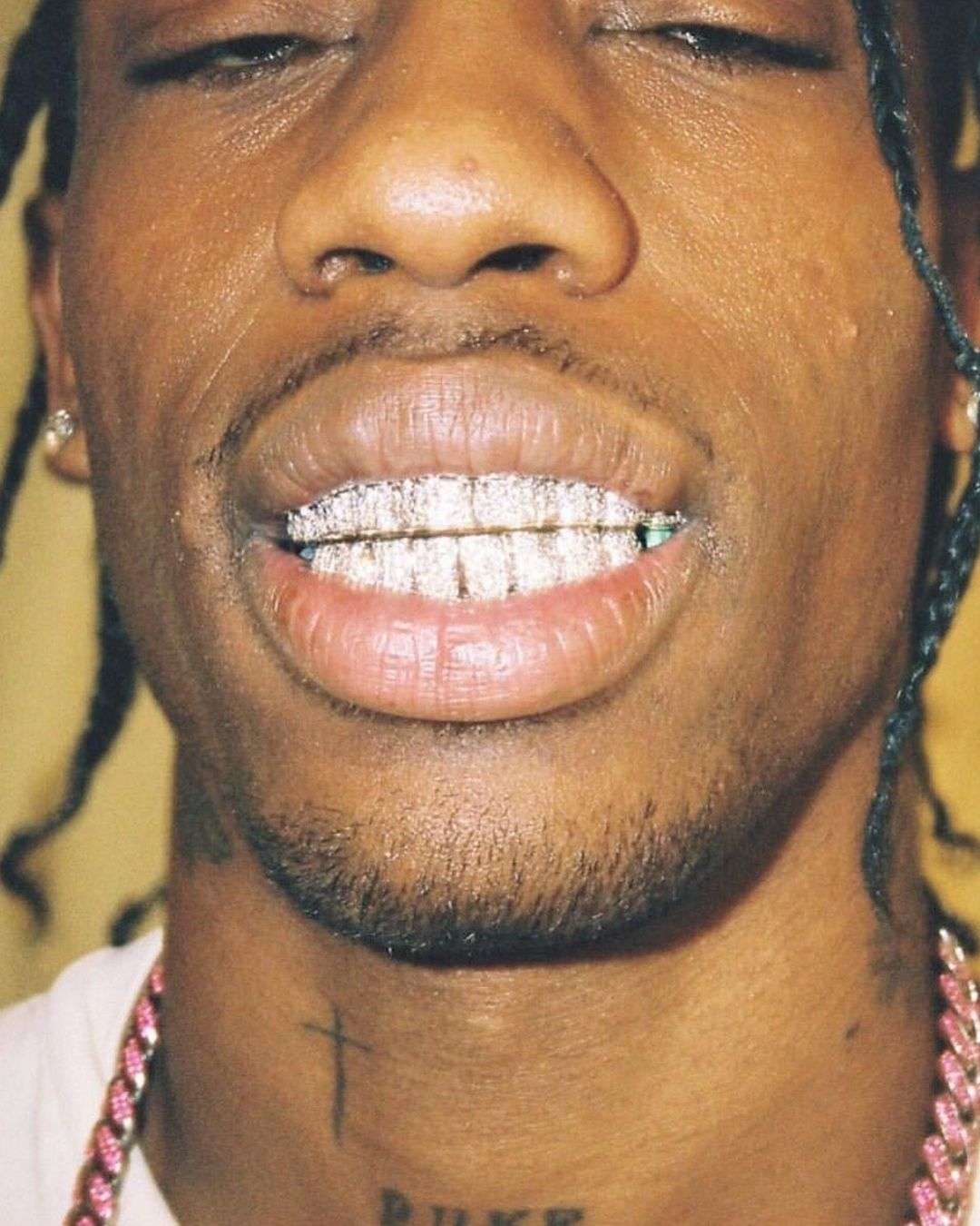 THE EVOLUTION OF GRILLZ